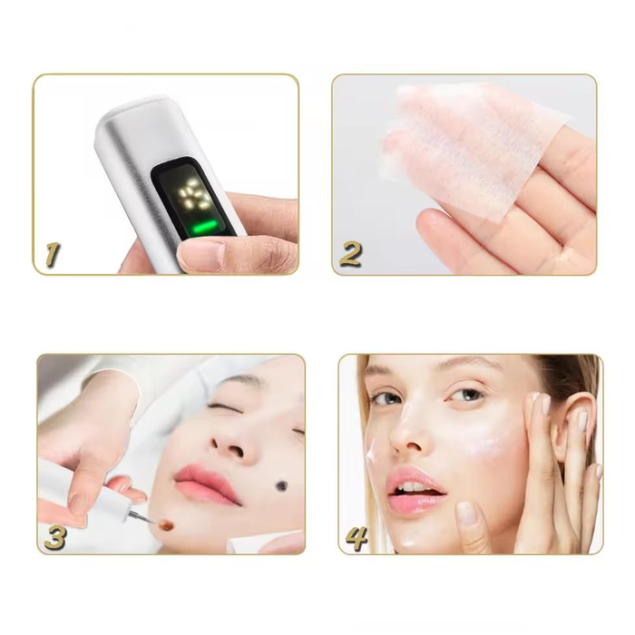 Penna Laser Plasma Rimozione Imperfezioni 15 Livelli