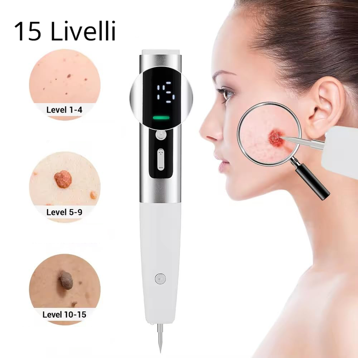 Penna Laser Plasma Rimozione Imperfezioni 15 Livelli