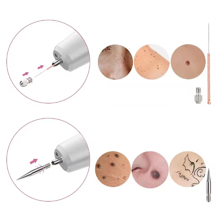 Penna Laser Plasma Rimozione Imperfezioni 15 Livelli