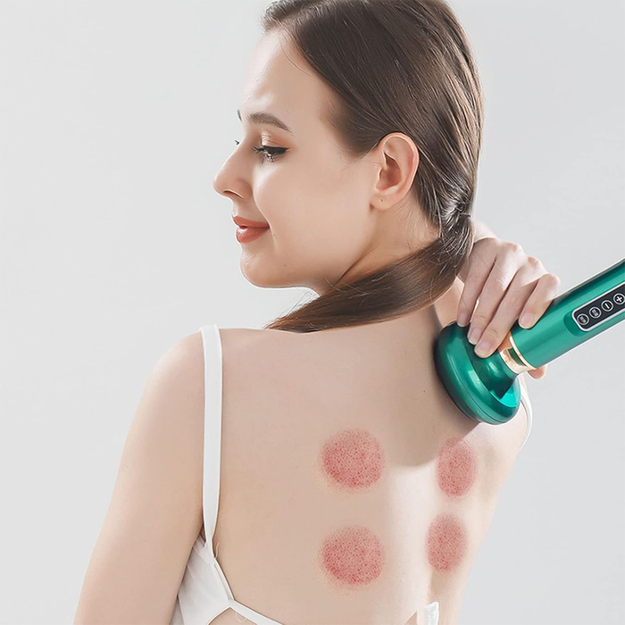 3-in-1 Smart Electric Cupping Therapy Massager with Adjustable Heat and Suction