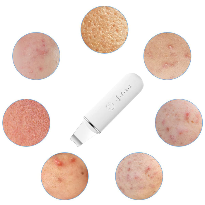 Scrubber Facciale Ricaricabile Ultrasonico