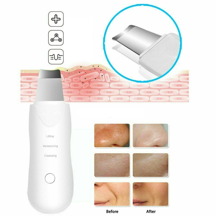 Scrubber Facciale Ricaricabile Ultrasonico