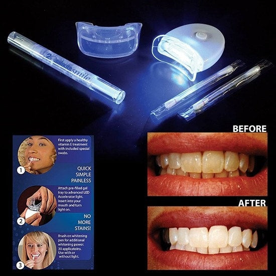 Luce LED sbiancante denti