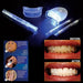 Luce LED sbiancante denti